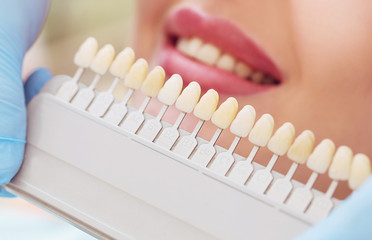 set of different colored teeth comparing to a patient’s smile